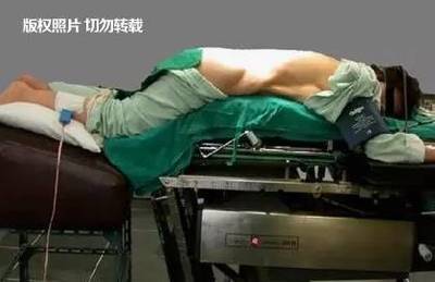 秦嶺土郎中擅治腰椎病,為腰椎病人換上“鐵腰板