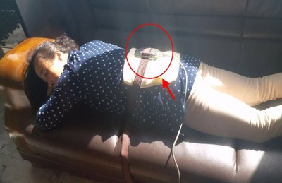 腰間盤突出怎么治好的快,鐵腰板真的能治療腰間盤突出嗎