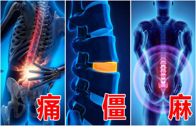 腰椎間盤突出的六大癥狀的什么?什么方法治療比較好呢?