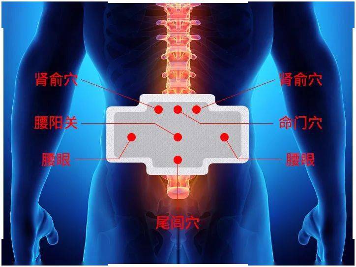 腰突腰肌勞損風濕性腰痛找準一個穴位每天一貼貼出鐵腰板兒從.